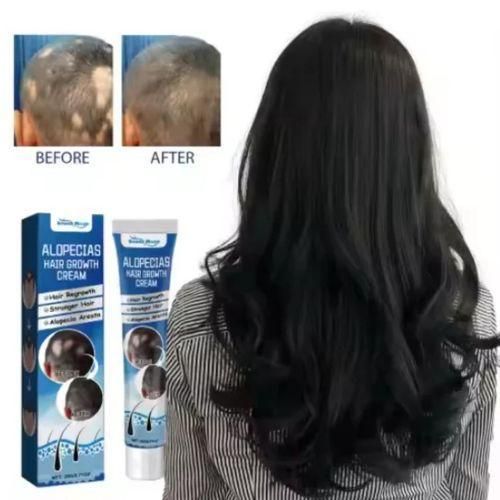 Alopecia Crema Para Crecimiento Capilar